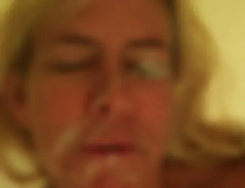 Voll ins Auge