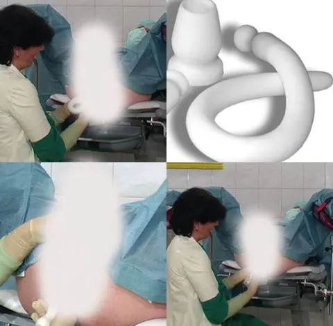 50 cm Analplug komplett - geil abgerotzt