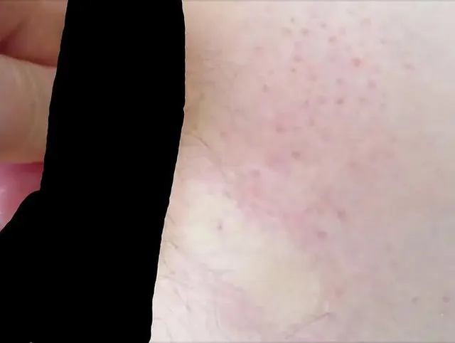 ERDAPFEL (KARTOFFEL) HINTEN EINGEFÜHRT !!! !!! !!!! !!!
